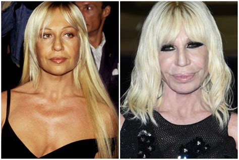 raffaella versace prima chirurgia|donna versace wikipedia.